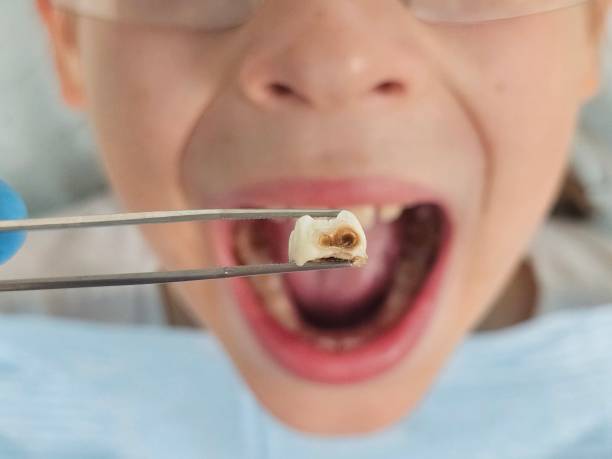 Best Broken or Chipped Tooth Repair in Oak Bluffs, MA